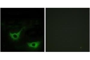 Immunofluorescence analysis of NIH-3T3 cells, using CALR Antibody. (Calreticulin Antikörper  (AA 21-70))