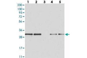 Western blot analysis of Lane 1: RT-4, Lane 2: U-251 MG, Lane 3: Human Plasma, Lane 4: Liver, Lane 5: Tonsil with MAPK1IP1L polyclonal antibody  at 1:250-1:500 dilution. (MAPK1IP1L Antikörper)