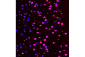 Immunofluorescence of paraffin embedded mouse brain using ALS2CR13 (ABIN7073909) at dilution of 1:650 (400x lens) (FAM117B Antikörper)