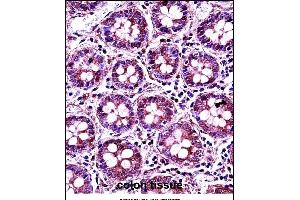 RANG Antibody (N-term) 3776a immunohistochemistry analysis in formalin fixed and paraffin embedded human colon tissue followed by peroxidase conjugation of the secondary antibody and DAB staining. (RANGAP1 Antikörper  (N-Term))