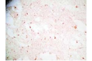 Human brain tissue was stained by Rabbit Anti-Synaptotagminm IV(73-97) (Human) Antibody (SYT4 Antikörper  (AA 73-97))