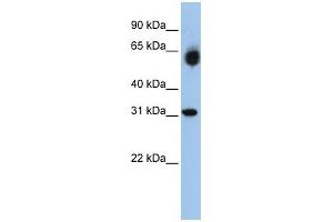 WB Suggested Anti-DHRS2  Antibody Titration: 0. (DHRS2 Antikörper  (Middle Region))