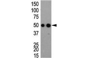 Western blot analysis of HA antibody and tagged recombinant protein bacterial lysate (HA-Tag Antikörper)