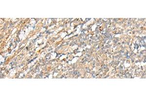 Immunohistochemistry of paraffin-embedded Human tonsil tissue using PCSK5 Polyclonal Antibody at dilution of 1:35(x200) (PCSK5 Antikörper)