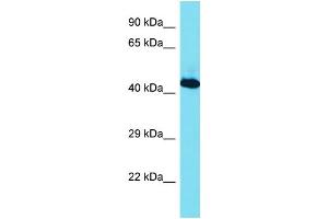 Host: Rabbit Target Name: RBMX Sample Type: Jurkat Whole Cell lysates Antibody Dilution: 1. (RBMX Antikörper  (C-Term))