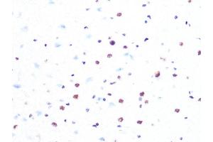 Immunohistochemistry of paraffin-embedded rat brain using PRPF8 Rabbit mAb (ABIN7269737) at dilution of 1:100 (40x lens). (PRPF8 Antikörper)