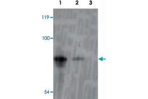 Western blot analysis of recombinant inaD protein using inaD polyclonal antibody  at 1:1000 dilution.