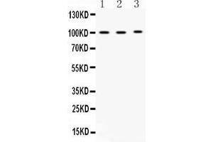 Western blot analysis of ADAM2 expression in rat testis extract ( Lane 1), mouse testis extract ( Lane 2) and MCF-7 whole cell lysates ( Lane 3). (ADAM2 Antikörper  (N-Term))