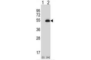 Western blot analysis of PAX6 (arrow) using rabbit polyclonal PAX6 Antibody . (PAX6 Antikörper)