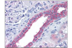 Human Kidney: Formalin-Fixed, Paraffin-Embedded (FFPE) (FAM33A Antikörper  (N-Term))