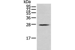 Western blot analysis of K562 cell using MOB1B Polyclonal Antibody at dilution of 1:250 (MOBKL1A Antikörper)
