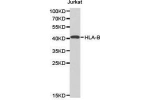 Western Blotting (WB) image for anti-Major Histocompatibility Complex, Class I, B (HLA-B) antibody (ABIN1873025) (HLA-B Antikörper)