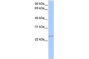 WB Suggested Anti-TCEAL1 Antibody Titration:  0. (TCEAL1 Antikörper  (Middle Region))