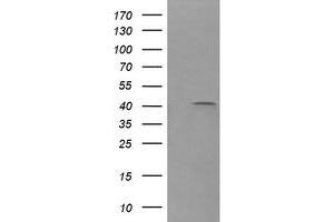 Image no. 2 for anti-Parvin, alpha (PARVA) antibody (ABIN1496443) (Parvin alpha Antikörper)