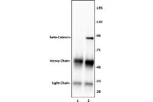 Immunoprecipitation (IP) image for anti-Catenin, beta (CATNB) (N-Term) antibody (ABIN6971443)