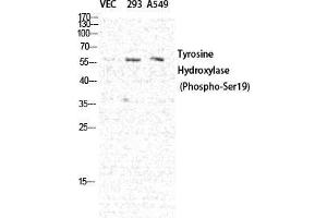 Western Blot (WB) analysis of specific cells using Phospho-TH (S19) Polyclonal Antibody. (TH Antikörper  (pSer19))