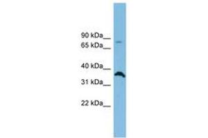 Image no. 1 for anti-Solute Carrier Family 6 (Neutral Amino Acid Transporter), Member 15 (SLC6A15) (AA 575-624) antibody (ABIN6744764) (SLC6A15 Antikörper  (AA 575-624))