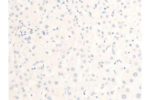 Immunohistochemistry (IHC) image for anti-Microphthalmia-Associated Transcription Factor (MITF) (pSer180), (pSer73) antibody (ABIN6255037)