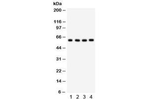 Western blot testing of 1) human placenta, 2) HepG2, 3) 293 and 4) HeLa lysate with HRPT2 antibody. (HRPT2 Antikörper  (AA 119-520))