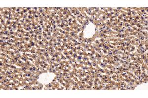 Detection of FUR in Mouse Liver Tissue using Polyclonal Antibody to Furin (FUR) (FURIN Antikörper  (AA 418-573))