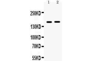 Observed bind size: 160KD (HDAC6 Antikörper  (N-Term))