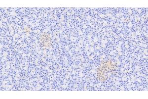 Detection of XRN1 in Human Pancreas Tissue using Polyclonal Antibody to 5'-3'Exoribonuclease 1 (XRN1) (XRN1 Antikörper  (AA 1394-1706))