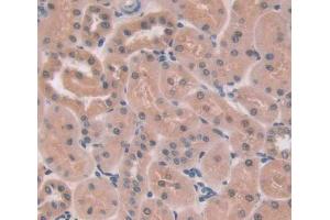 Used in DAB staining on fromalin fixed paraffin- embedded kidney tissue (PTPN13 Antikörper  (AA 1-161))