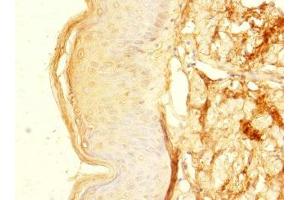 Immunohistochemistry of paraffin-embedded human skin tissue using ABIN7176351 at dilution of 1:100 (ZNF513 Antikörper  (AA 1-300))