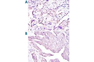 Immunohistochemical analysis of paraffin-embedded human placenta tissues (A) and ovarian cancer (B) using E7 monoclonal antibody, clone 6F3  with DAB staining.