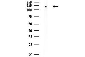 anti-DNA Repair Protein Complementing XP-G Cells (ERCC5) (N-Term) antibody