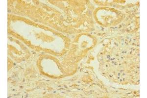 Immunohistochemistry (IHC) image for anti-Roundabout, Axon Guidance Receptor, Homolog 2 (ROBO2) (AA 450-660) antibody (ABIN7168444)