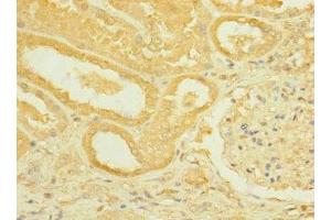 Immunohistochemistry of paraffin-embedded human kidney tissue using ABIN7168444 at dilution of 1:100 (ROBO2 Antikörper  (AA 450-660))