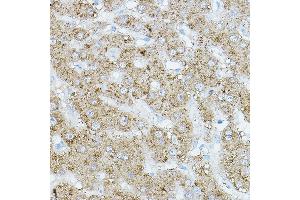 Immunohistochemistry of paraffin-embedded human liver using EIF2 Rabbit pAb (ABIN6131600, ABIN6140021, ABIN6140022 and ABIN6218371) at dilution of 1:500 (40x lens). (EIF2AK1 Antikörper  (AA 371-630))