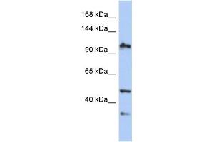 WB Suggested Anti-XAB2 Antibody Titration:  0. (XAB2 Antikörper  (N-Term))