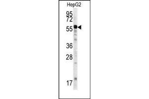 Image no. 1 for anti-Matrix Metalloproteinase 20 (MMP20) (Middle Region) antibody (ABIN358692) (MMP20 Antikörper  (Middle Region))