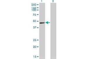 Western Blot analysis of TNFRSF19L expression in transfected 293T cell line by TNFRSF19L monoclonal antibody (M01), clone 3F8. (RELT Antikörper  (AA 26-124))