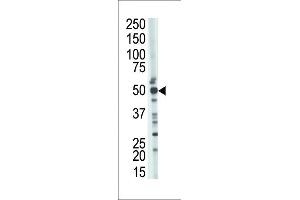 The anti-TSABIN486223 and ABIN1535604 Pab (ABIN388926 and ABIN2839200) is used in Western blot to detect TSABIN486223 and ABIN1535604 in mouse kidney tissue lysate. (TSG101 Antikörper  (N-Term))