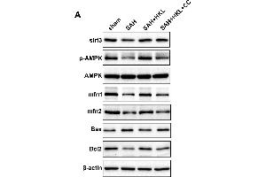 SIRT3 protected mitochondrial fusion proteins Mfn1 and Mfn2 after SAH in an AMPK-dependent manner. (MFN1 Antikörper  (AA 622-741))