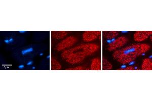 Rabbit Anti-FPGS Antibody Catalog Number: ARP63438_P050 Formalin Fixed Paraffin Embedded Tissue: Human heart Tissue Observed Staining: Cytoplasmic in mitochondria Primary Antibody Concentration: N/A Other Working Concentrations: 1:600 Secondary Antibody: Donkey anti-Rabbit-Cy3 Secondary Antibody Concentration: 1:200 Magnification: 20X Exposure Time: 0.