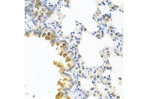 Immunohistochemistry of paraffin-embedded mouse lung using SERPINA3 antibody at dilution of 1:100 (40x lens). (SERPINA3 Antikörper)