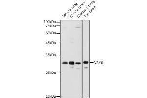 Western blot analysis of extracts of various cell lines, using VAPB antibody (ABIN6132783, ABIN6150058, ABIN6150059 and ABIN6221003) at 1:1000 dilution. (VAPB Antikörper  (AA 10-222))