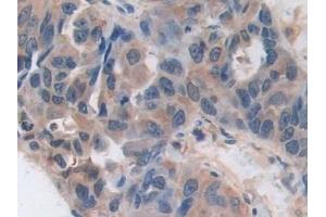 Immunohistochemistry (IHC) image for anti-Arrestin, beta 1 (ARRB1) (AA 3-246) antibody (ABIN7441790)