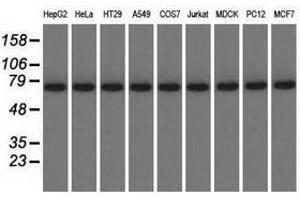 Image no. 2 for anti-Kelch Repeat and BTB (POZ) Domain Containing 7 (KBTBD7) antibody (ABIN1498995) (KBTBD7 Antikörper)