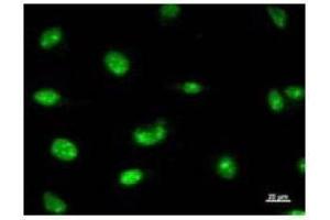 Immunostaining analysis in HeLa cells. (RPP30 Antikörper)