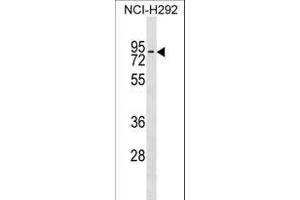 ZN Antibody (Center) (ABIN1538077 and ABIN2849760) western blot analysis in NCI- cell line lysates (35 μg/lane). (ZNF551 Antikörper  (AA 208-235))