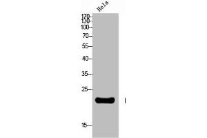 Western Blot analysis of HELA cells using Neurotensin Polyclonal Antibody (Neurotensin Antikörper  (C-Term))