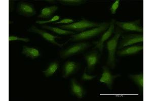 Immunofluorescence (IF) image for anti-Nuclear Factor of Activated T-Cells, Cytoplasmic, Calcineurin-Dependent 4 (NFATC4) (AA 1-902) antibody (ABIN518313)