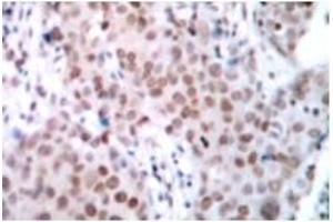 Image no. 1 for anti-Estrogen Receptor 1 (ESR1) (pSer104) antibody (ABIN318016) (Estrogen Receptor alpha Antikörper  (pSer104))
