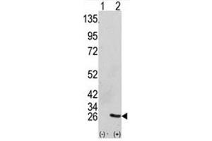 Western Blotting (WB) image for anti-Growth Factor Receptor-Bound Protein 2 (GRB2) (AA 89-118) antibody (ABIN3031114)