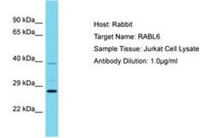 Image no. 1 for anti-KIAA1984 (KIAA1984) (AA 67-116) antibody (ABIN6750638) (CCDC183/KIAA1984 Antikörper  (AA 67-116))